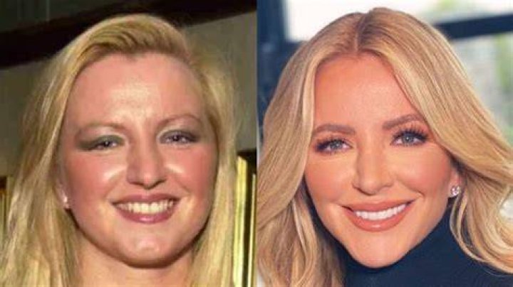 michael mone plastic surgery