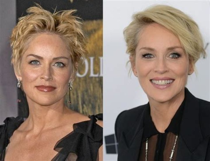 Sharon Stone Plastic Surgery Before and After